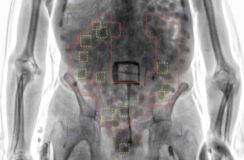 Over 20,000 attempts to smuggle contraband thwarted by X-ray body scanners