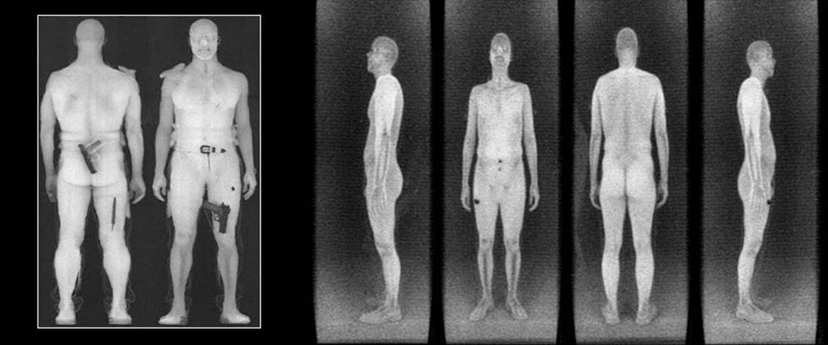 x ray body scanner