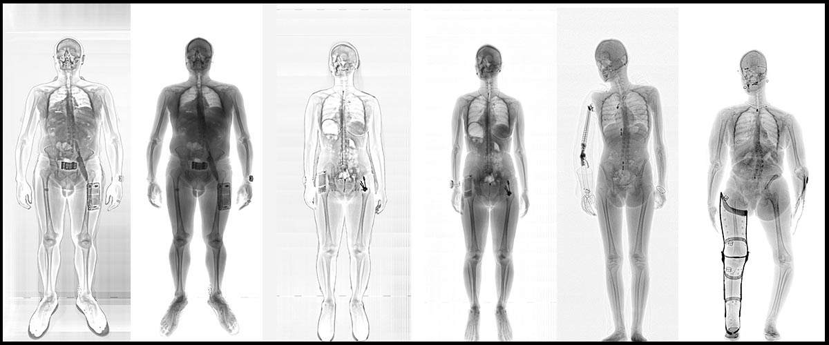 X-ray Body scanner for jail, prison – LINEV Systems