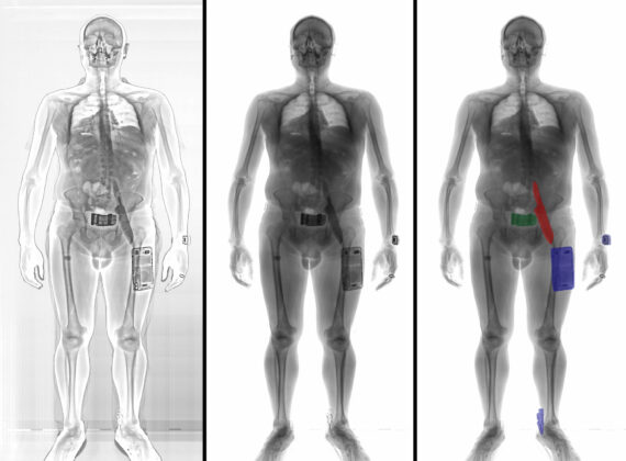 CLEARPASS xray