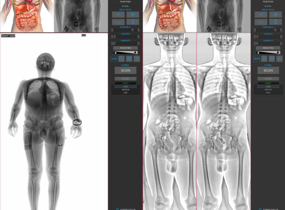 CONPASS SMART DV X-ray