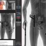 CONPASS SMART TR X-ray